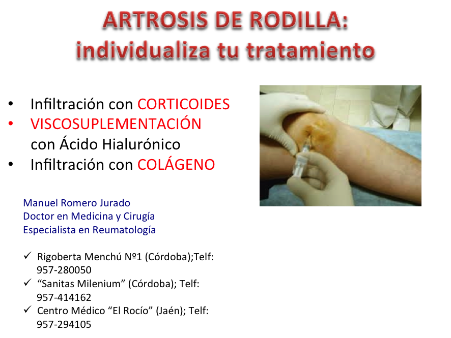 Qué tratamientos existen para de Rodilla? – reumatologomanuelromero.com
